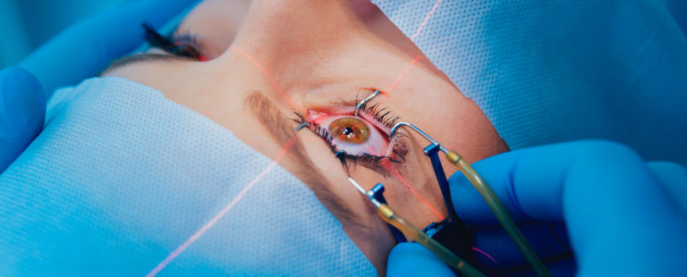 paciente sendo analisado com abordagem de Facoemulsificação