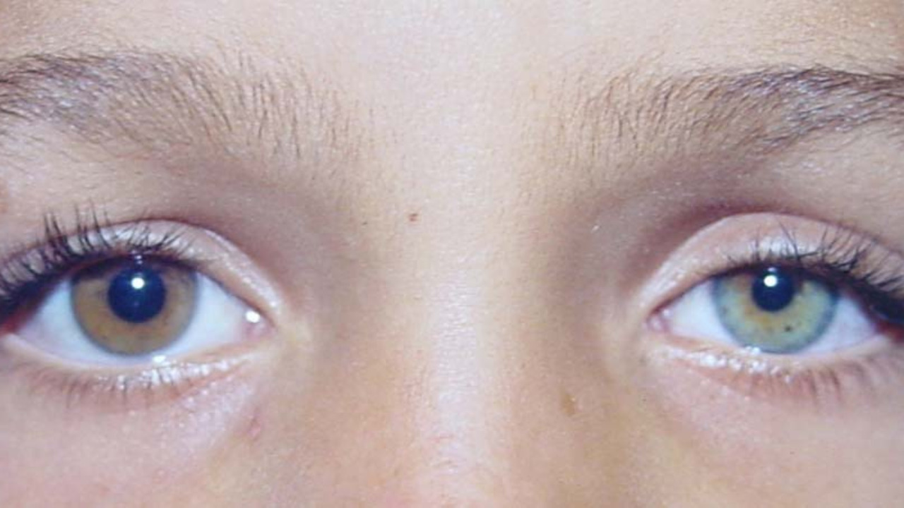 olhos cores diferentes