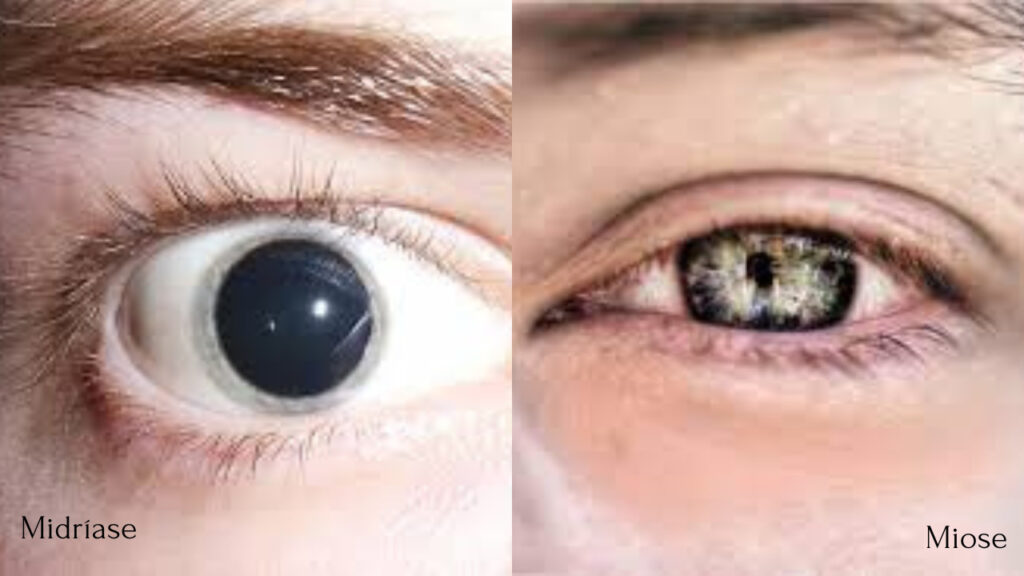 olhos em midriase e miose