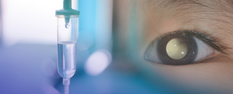 Olho próximo a um gotejador de soro intravenoso